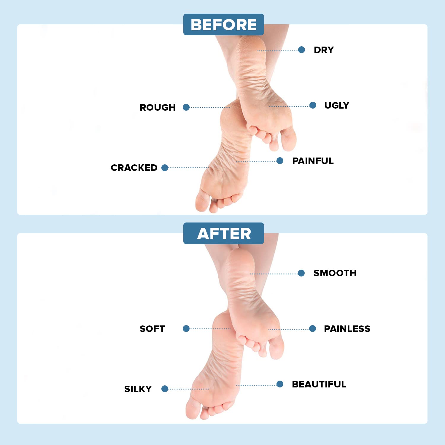 Heel Balm | Dermal Therapy Heel Balm | Dermal Therapy