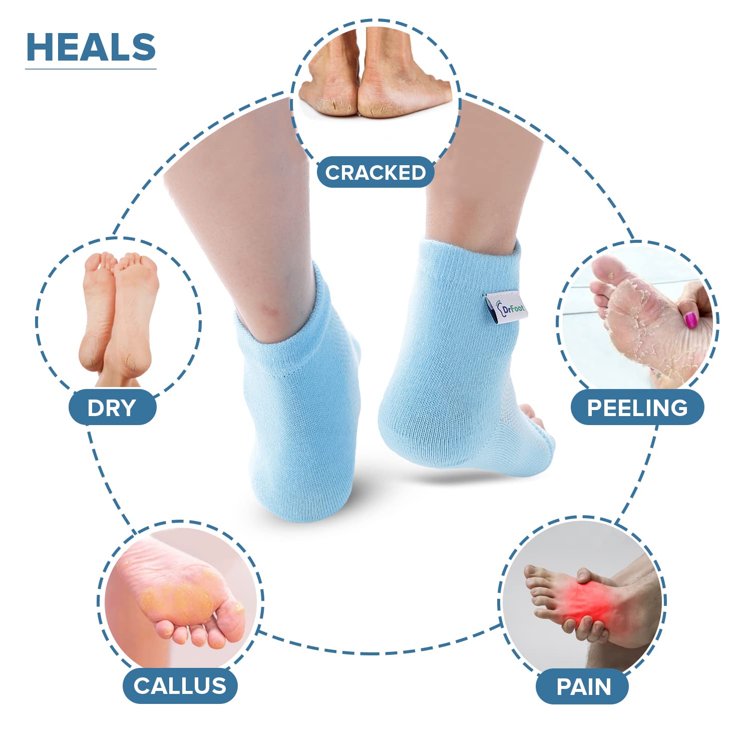 Moisturizing Socks Cracked Heel Treatment - Treat Dry Feet & Heels Fast.  Pain Relief from Cracking Foot Skin with Aloe Moisturizer Lotion Infused  Gel Heel Socks. Pedicure for Both Women & Men (