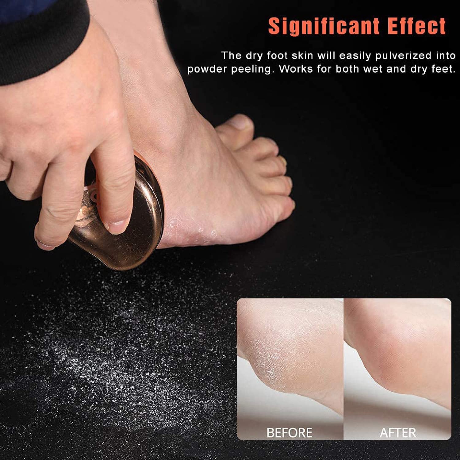 Dr Foot Callus Remover Gel Helps to remove Calluses and Corns also –  Drfootin